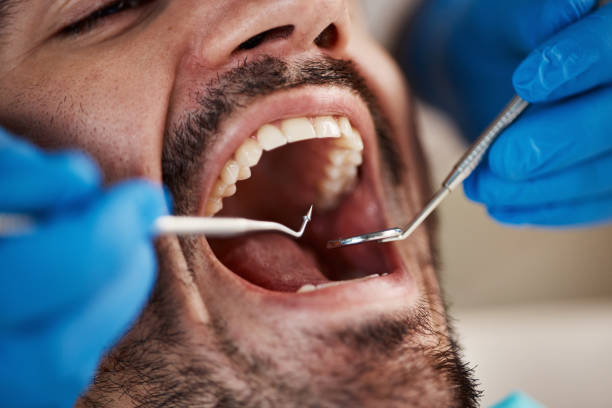 Best Emergency Dental Extractions in Kennett, MO